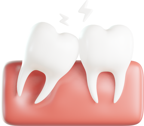 Wisdom teeth 3D